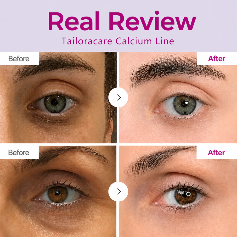 🔥LAST DAY 50% OFF!!Tailoracare Korean Calcium Dark Spot Eye Cream