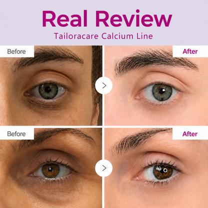 🔥LAST DAY 50% OFF!!Tailoracare Korean Calcium Dark Spot Eye Cream