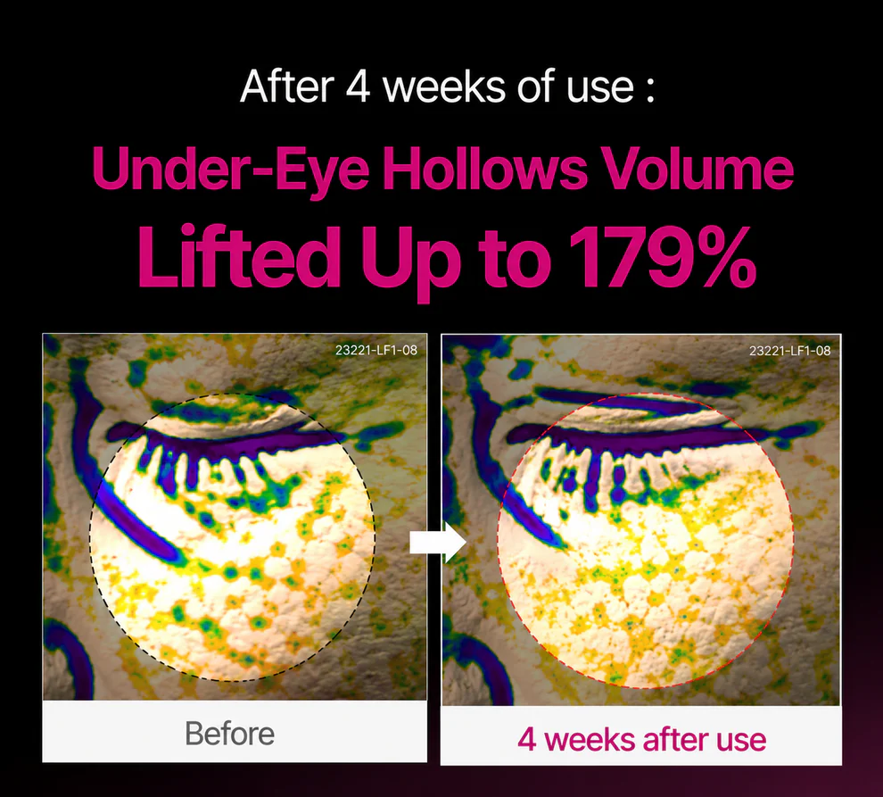 🔥LAST DAY 50% OFF!!Tailoracare Korean Calcium Dark Spot Eye Cream